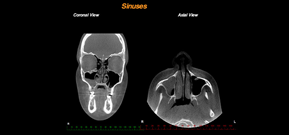 Sinus View 01