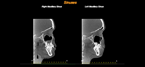 Sinus View 02